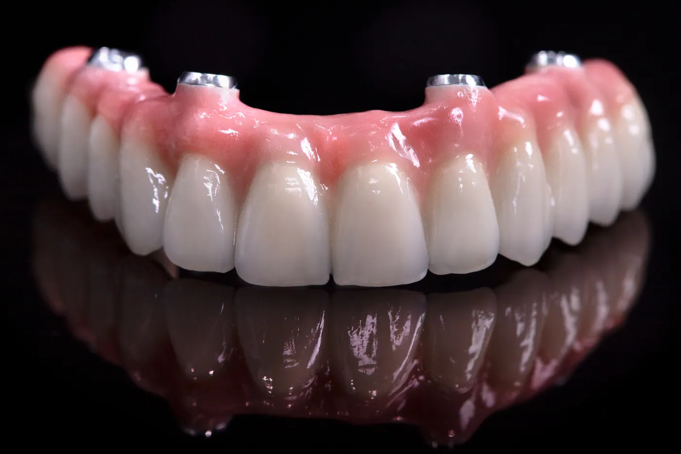 A fixed full-arch prosthesis made in our clinic